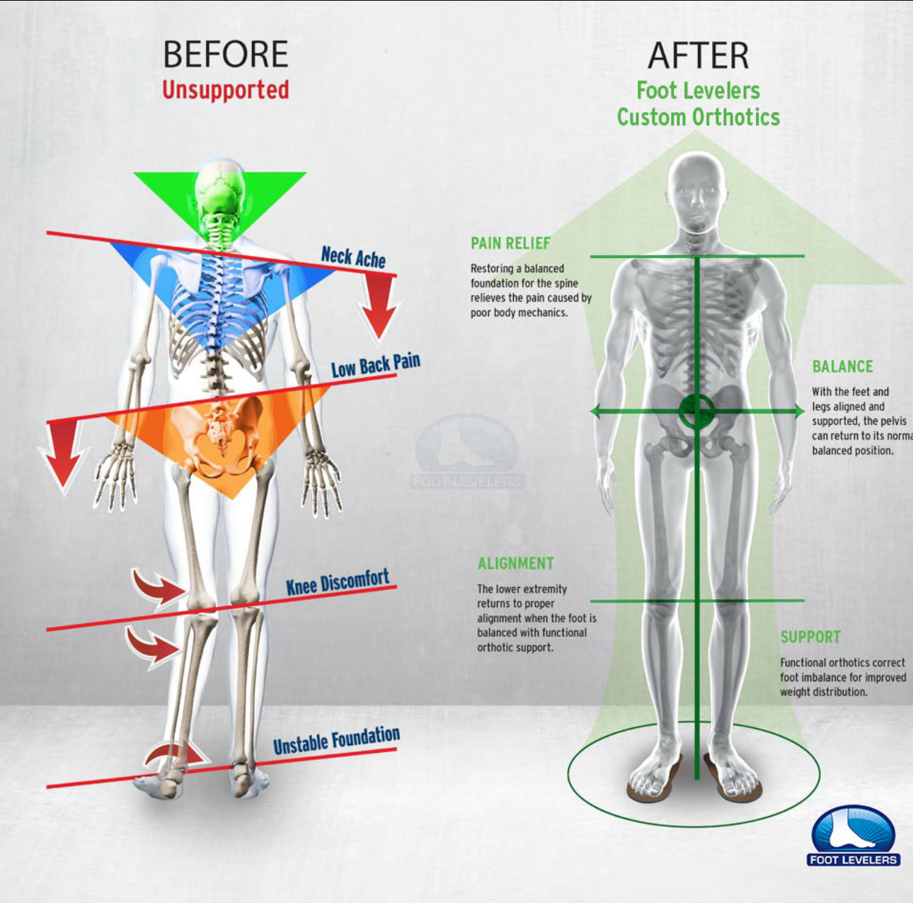 WHIEDA Ortopediska Sulor – Fotvärk Relief & Arch Support | Orthopedic Insoles